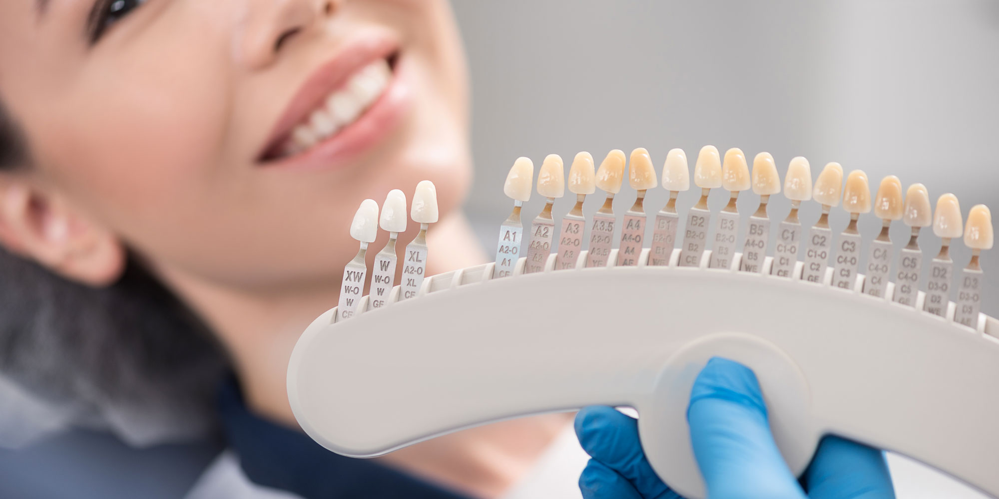 veneer patient being shown options